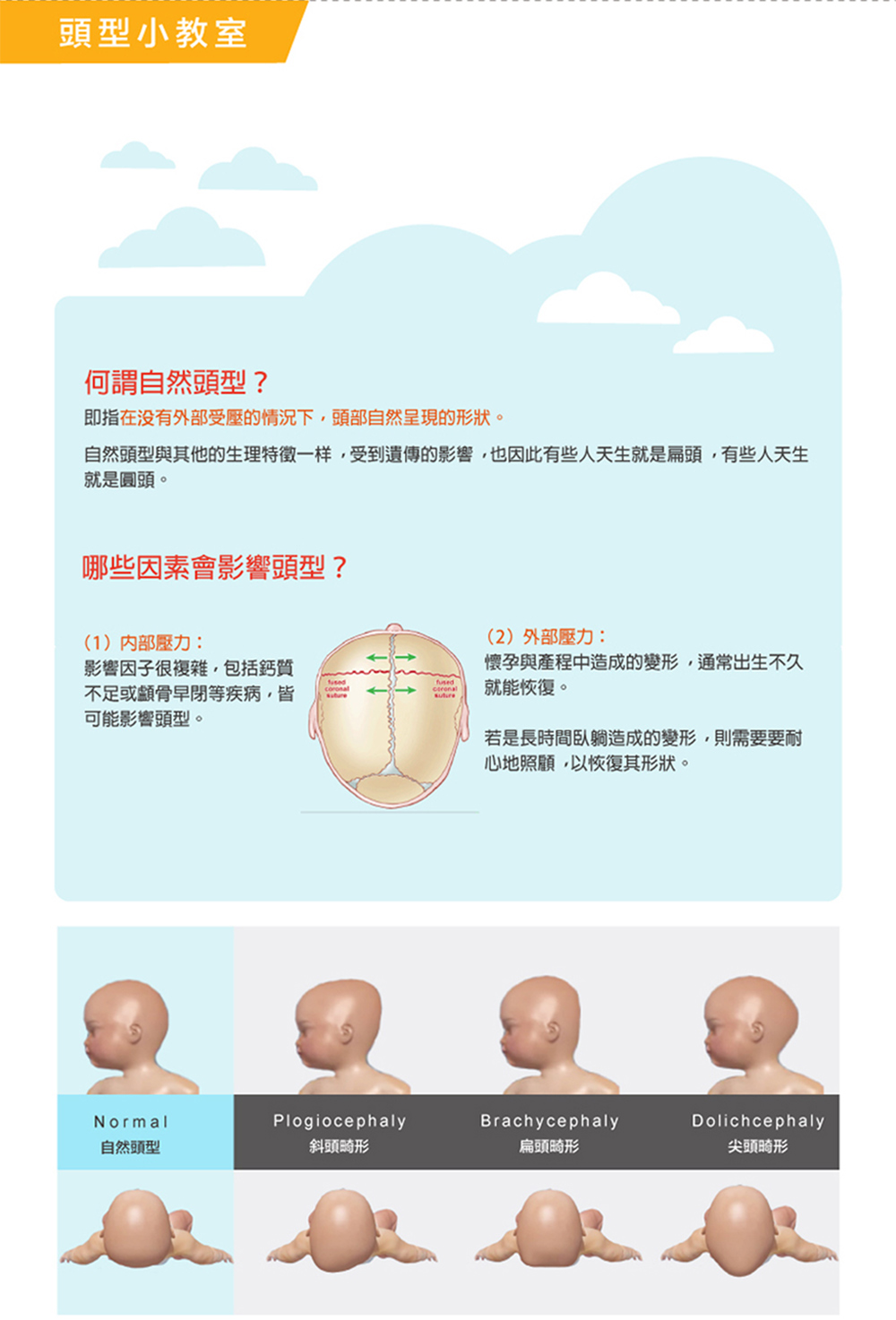 自然頭型與其他的生理特徵一样,受到遺傳的影響,也因此有些人天生就是扁頭,有些人天生