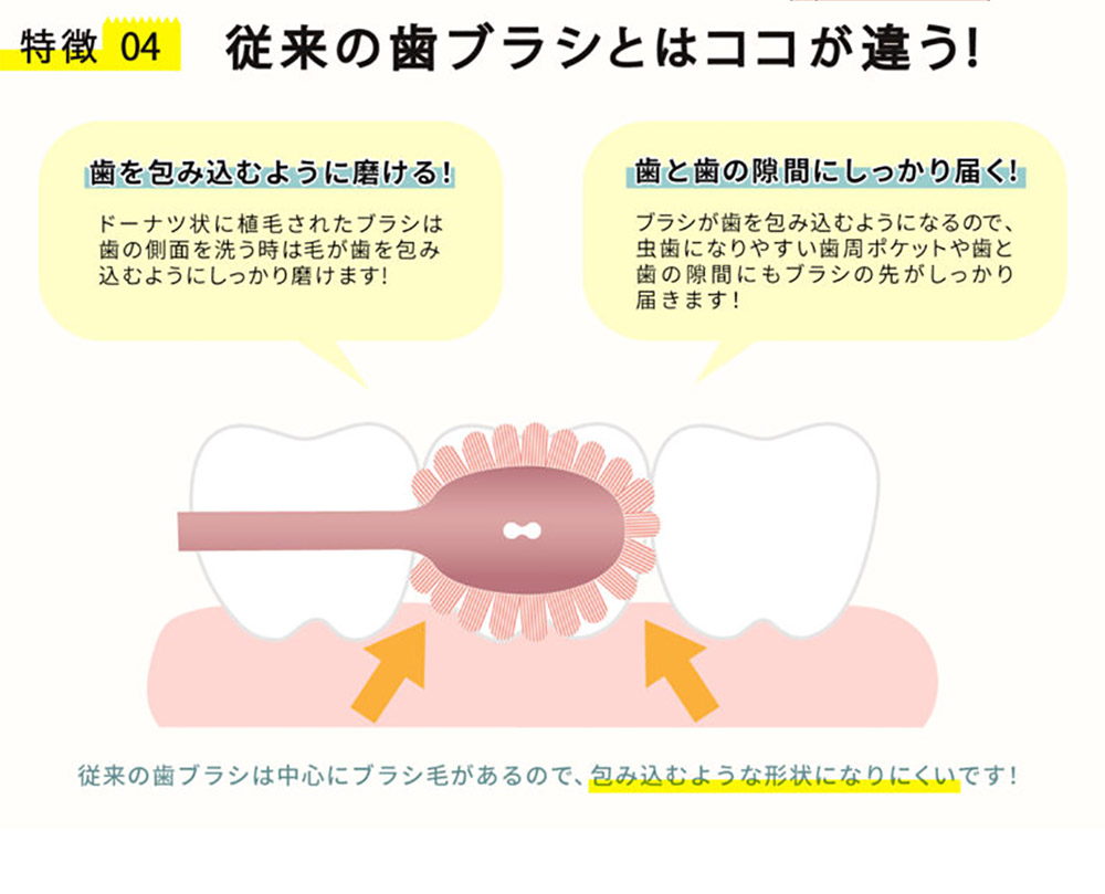 従来歯中心毛、包込形状