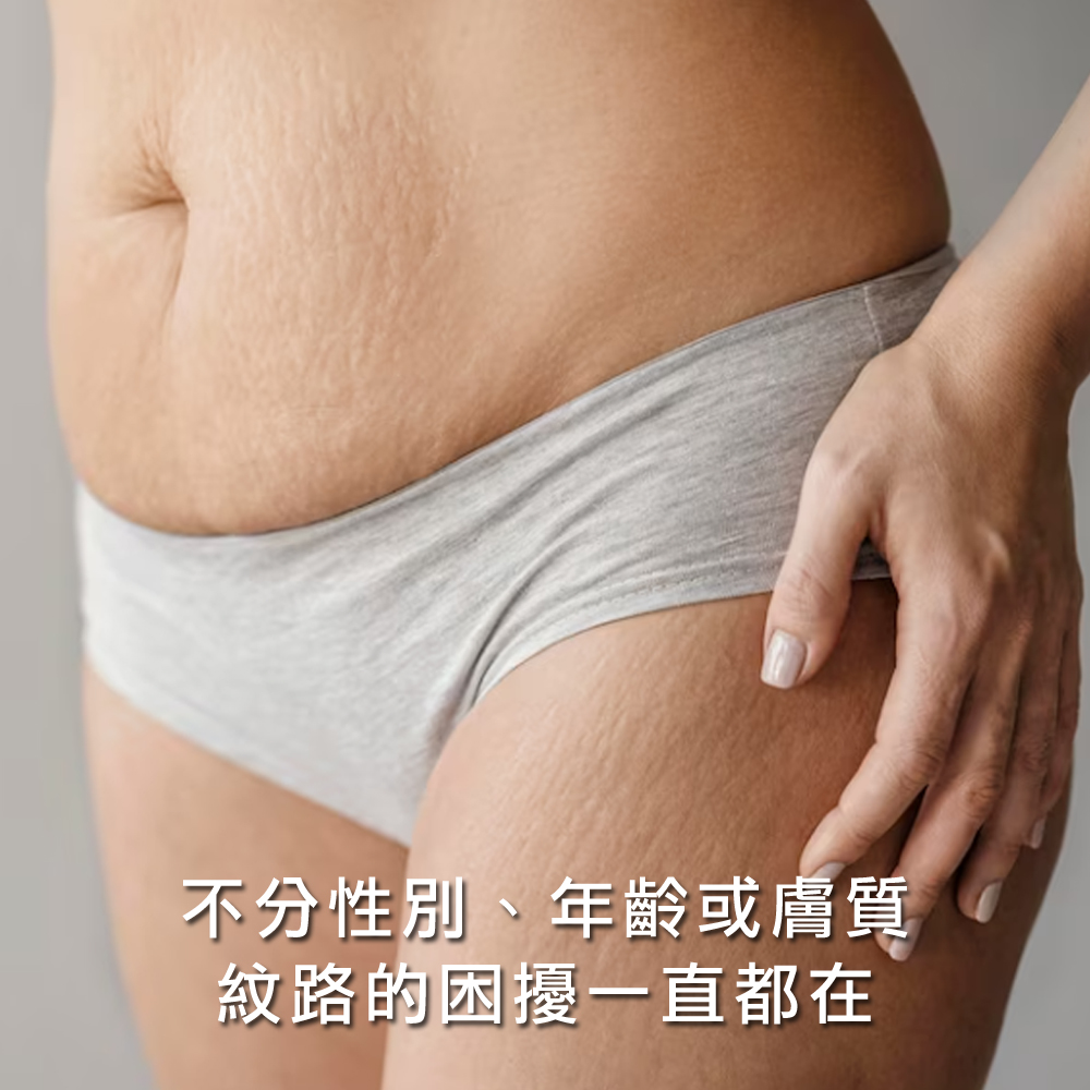 不分性別、年齡或膚質 紋路的困擾一直都在 
