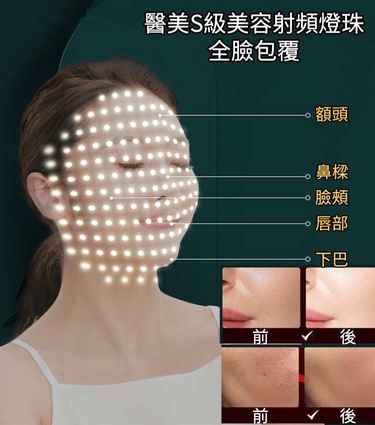 醫美S級美容射頻燈珠