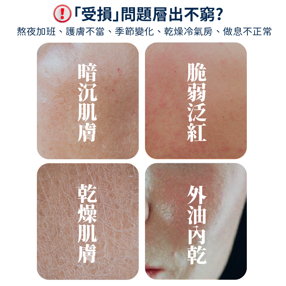 熬夜加班、護膚不當、季節變化、乾燥冷氣房、做息不正常