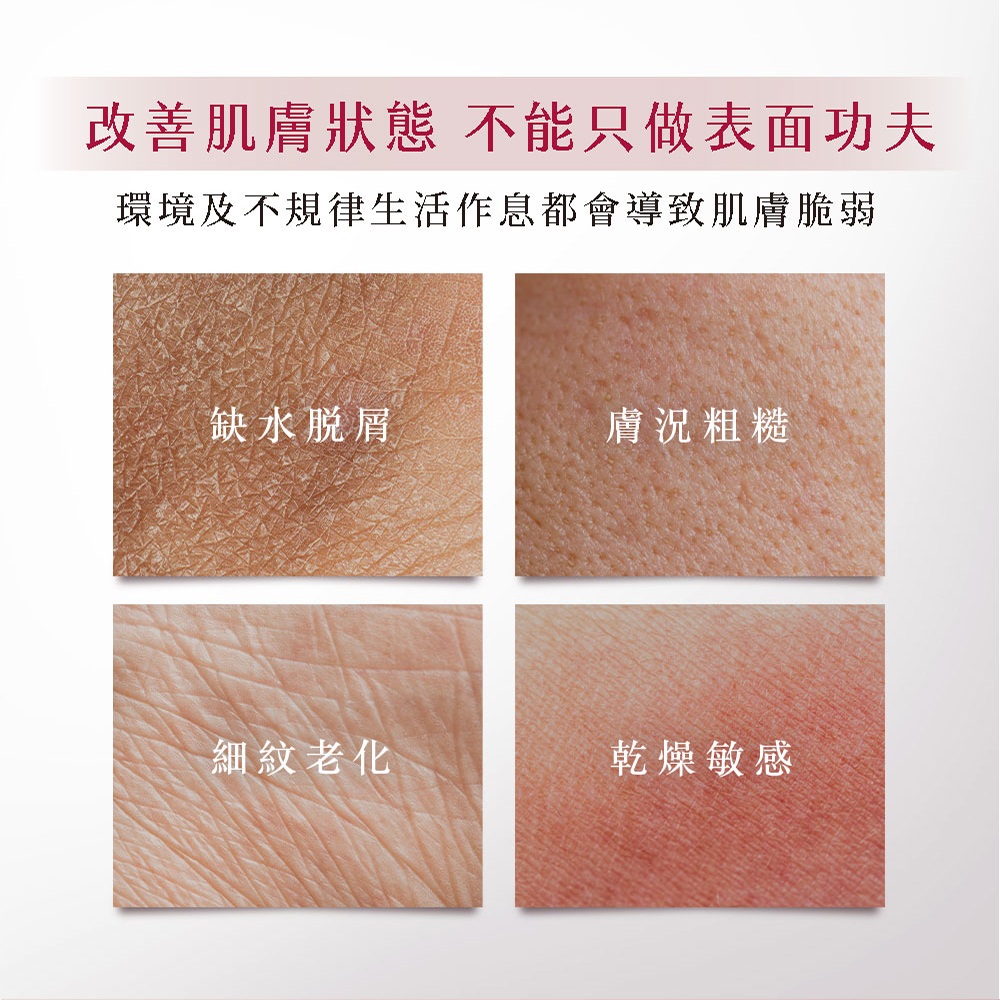 環境及不規律生活作息都會導致肌膚脆弱