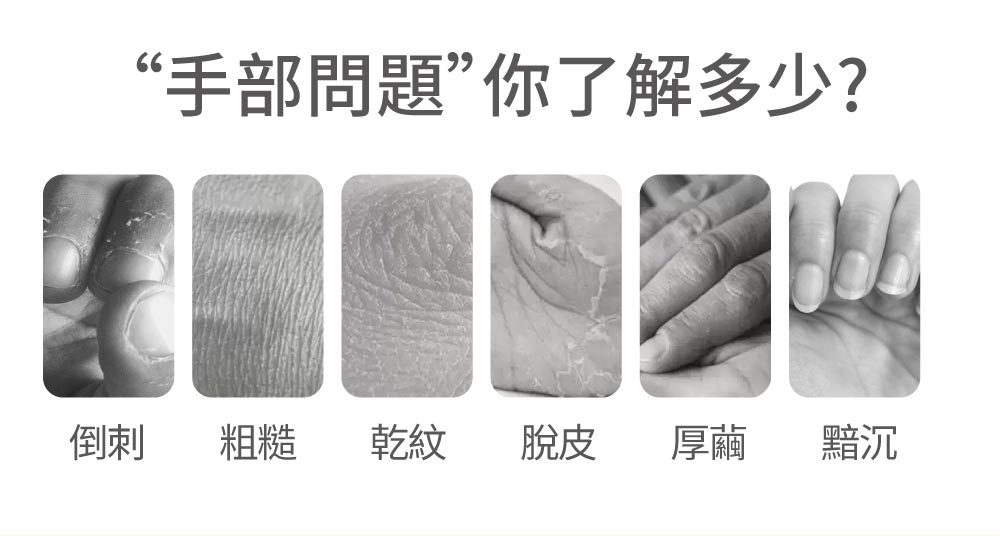 æé¨åé¡ä½ äºè§£å¤å° ååº ç²ç³ ä¹¾ç´ è«ç® åç¹­ é»¯æ² 