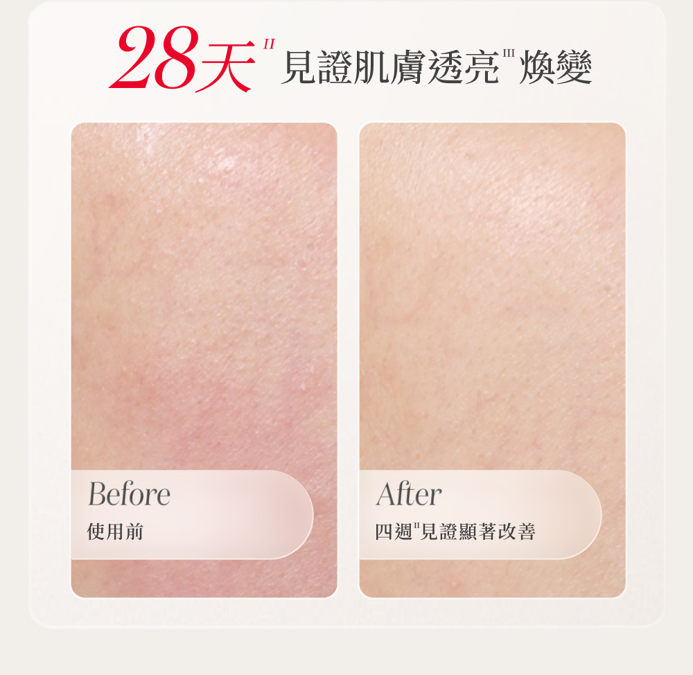 28天見證肌膚透亮煥變 使用前 四週見證顯著改善 